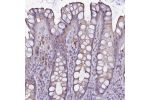 Immunohistochemical staining of human rectum shows moderate cytoplasmic positivity in glandular cells.