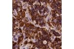 Immunohistochemical staining of human pituitary gland shows strong cytoplasmic positivity in cells in anterior lobe.