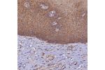 Immunohistochemical staining of human esophagus shows strong cytoplasmic positivity in squamous epithelial cells.