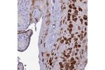 Immunohistochemical staining of human Placenta shows strong cytoplasmic positivity in decidual cells.