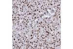 Immunohistochemical staining of human liver shows strong nuclear positivity in hepatocytes.