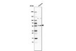 Western blot analysis in human plasma.