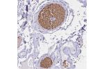 Immunohistochemical staining of human colon shows distinct staining in red blood cells.