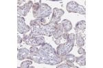 Immunohistochemical staining of human placenta shows strong granular cytoplasmic positivity in a subset of trophoblastic cells.