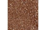 Immunohistochemical staining of human liver shows strong cytoplasmic positivity in hepatocytes.