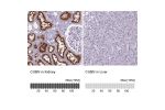 Immunohistochemistry analysis in human kidney and liver tissues using HPA043854 antibody. Corresponding CUBN RNA-seq data are presented for the same tissues.