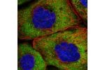 Immunofluorescent staining of human cell line A-431 shows localization to cytosol & vesicles.