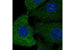 Immunofluorescent staining of human cell line A549 shows localization to cytosol.