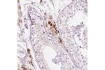 Immunohistochemical staining of human testis shows moderate granular cytoplasmic positivity in Leydig cells.