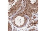 Immunohistochemical staining of human testis shows strong nuclear and cytoplasmic positivity in cells in seminiferus ducts and Leydig cells.