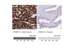 Immunohistochemistry analysis in human heart muscle and prostate tissues using HPA043898 antibody. Corresponding MYBPC3 RNA-seq data are presented for the same tissues.