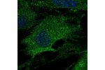 Immunofluorescent staining of human cell line BJ shows localization to endoplasmic reticulum.