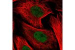 Immunofluorescent staining of human cell line U-2 OS shows localization to nucleoplasm.
