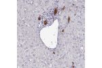 Immunohistochemical staining of human liver shows strong cytoplasmic positivity in bile duct cells.