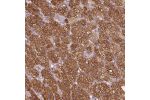 Immunohistochemical staining of human adrenal gland shows strong cytoplasmic positivity in zona fasciculata.