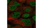 Immunofluorescent staining of human cell line CACO-2 shows localization to nucleoplasm.
