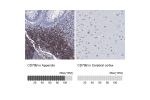 Immunohistochemistry analysis in human appendix and cerebral cortex tissues using Anti-CD79B antibody. Corresponding CD79B RNA-seq data are presented for the same tissues.