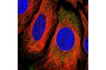 Immunofluorescent staining of human cell line HeLa shows localization to cytosol.