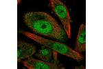 Immunofluorescent staining of human cell line PC-3 shows localization to nucleoplasm.