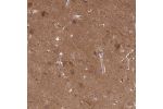 Immunohistochemical staining of human cerebral cortex shows moderate positivity in neuropil.