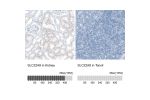 Immunohistochemistry analysis in human kidney and tonsil tissues using HPA044174 antibody. Corresponding SLC22A8 RNA-seq data are presented for the same tissues.
