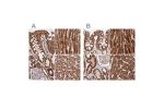 Immunohistochemical staining of human colon, heart muscle, kidney and liver using Anti-ATP5A1 antibody HPA044202 (A) shows similar protein distribution across tissues to independent antibody HPA040622 (B).