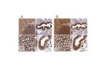 Immunohistochemical staining of human cerebellum, fallopian tube, kidney and testis using Anti-TRAP1 antibody HPA044227 (A) shows similar protein distribution across tissues to independent antibody HPA041082 (B).