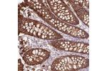 Immunohistochemical staining of human colon shows strong membranous positivity in glandular cells.