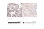 Immunohistochemistry analysis in human testis and liver tissues using HPA044341 antibody. Corresponding CIC RNA-seq data are presented for the same tissues.