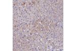 Immunohistochemical staining of human liver shows moderate membranous positivity in hepatocytes.