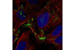 Immunofluorescent staining of human cell line U-2 OS shows localization to plasma membrane.