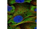 Immunofluorescent staining of human cell line U-2 OS shows localization to nucleoplasm, cytosol & actin filaments.