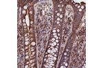 Immunohistochemical staining of human rectum shows strong cytoplasmic positivity in glandular cells.