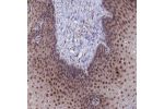 Immunohistochemical staining of human esophagus shows strong nuclear positivity in squamous epithelial cells.