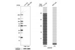 Western blot analysis in human cell lines U2OS and HEK293 using Anti-GSDMD antibody. Corresponding GSDMD RNA-seq data are presented for the same cell lines. Loading control: Anti-HSP90B1.