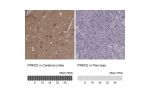 Immunohistochemistry analysis in human cerebral cortex and pancreas tissues using HPA044496 antibody. Corresponding PRKCE RNA-seq data are presented for the same tissues.