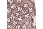 Immunohistochemical staining of human rectum shows moderate cytoplasmic positivity in glandular cells.