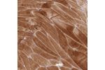 Immunohistochemical staining of human skeletal muscle shows strong cytoplasmic positivity in myocytes.