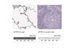 Immunohistochemistry analysis in human lung and lymph node tissues using HPA044582 antibody. Corresponding SFTPD RNA-seq data are presented for the same tissues.