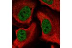 Immunofluorescent staining of human cell line U-2 OS shows localization to nucleoplasm.