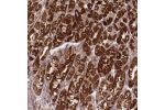 Immunohistochemical staining of human stomach, upper shows strong cytoplasmic positivity in glandular cells.