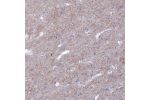 Immunohistochemical staining of human cerebral cortex shows moderate granular cytoplasmic positivity in neuropil.