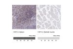 Immunohistochemistry analysis in human spleen and skeletal muscle tissues using HPA044658 antibody. Corresponding CD72 RNA-seq data are presented for the same tissues.