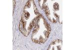 Immunohistochemical staining of human prostate shows moderate membranous positivity in glandular cells.