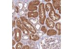 Immunohistochemical staining of human Kidney shows strong cytoplasmic positivity in cells in tubules.