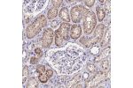 Immunohistochemical staining of human kidney shows moderate cytoplasmic positivity in cells in tubules.