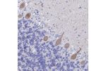 Immunohistochemical staining of human cerebellum shows moderate membranous and cytoplasmic positivity in Purkinje cells.