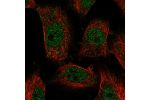 Immunofluorescent staining of human cell line U-251 MG shows localization to nucleoplasm.