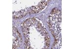 Immunohistochemical staining of human testis shows cytoplasmic positivity in cells in seminiferous ducts.
