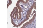 Immunohistochemical staining of human fallopian tube shows strong cytoplasmic positivity in glandular cells.